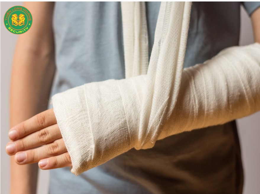 Hướng Dẫn Sơ Cứu Gãy Xương Đúng Cách